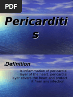 Pericarditis