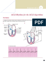 ECG Rhythms for ACLS