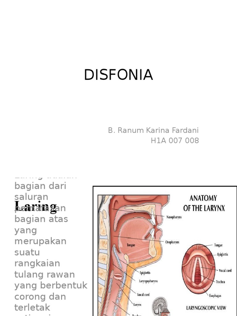 DISFONIA | PDF