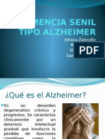 Enfermedad de Alzheimer