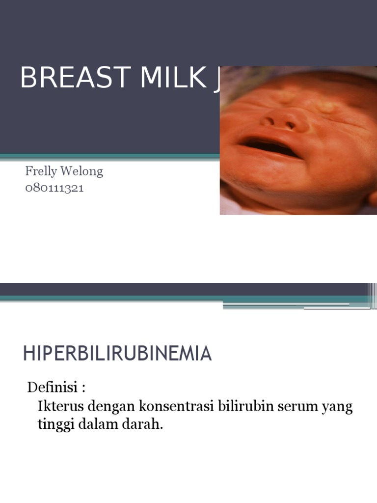 Breast Milk Jaundice PDF