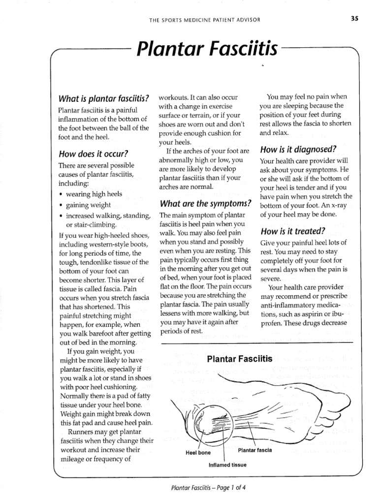 35 38 Plantar Fasciitis