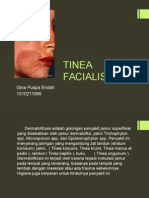 Tinea Facialis