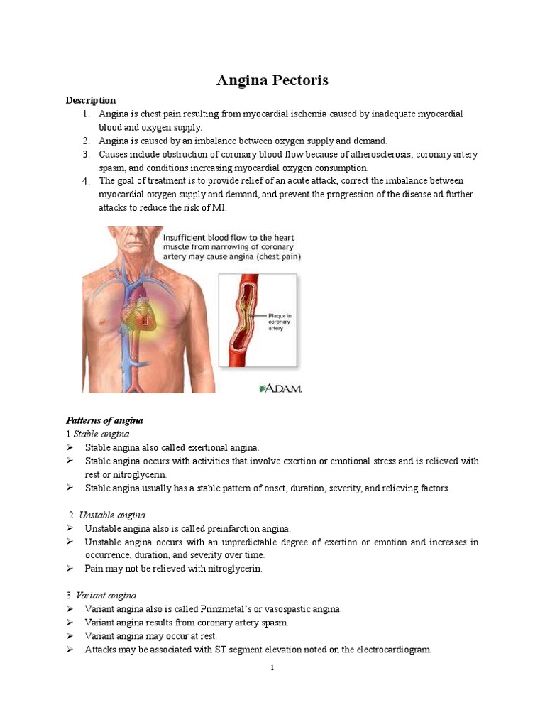 Angina Pectoris | Angina Pectoris | Coronary Artery Disease