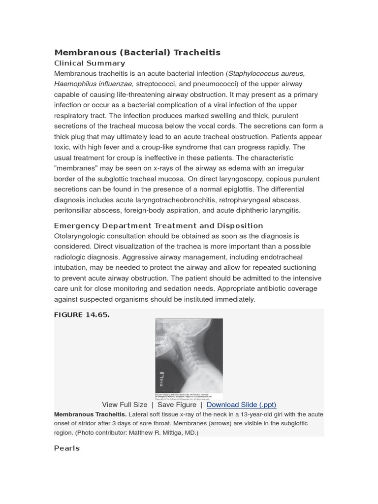 Tracheitis | Pulmonology | Respiratory Diseases
