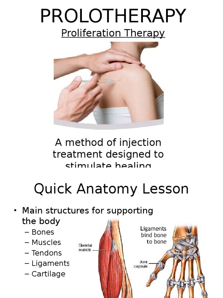 A Guide to Prolotherapy An Effective NonSurgical Treatment for Tendon