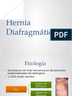 Hernia Diafragmática