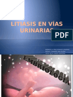 litiasis renal 