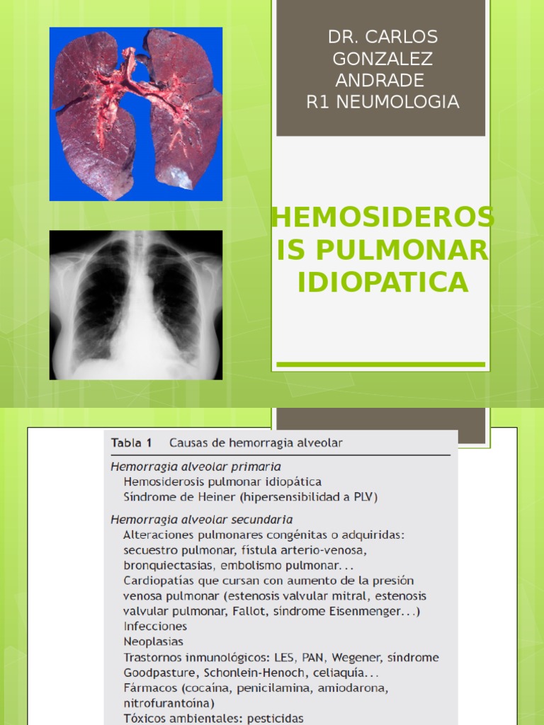 Hemosiderosis Pulmonar Idiopatica PDF Inmunología Ciencias de la