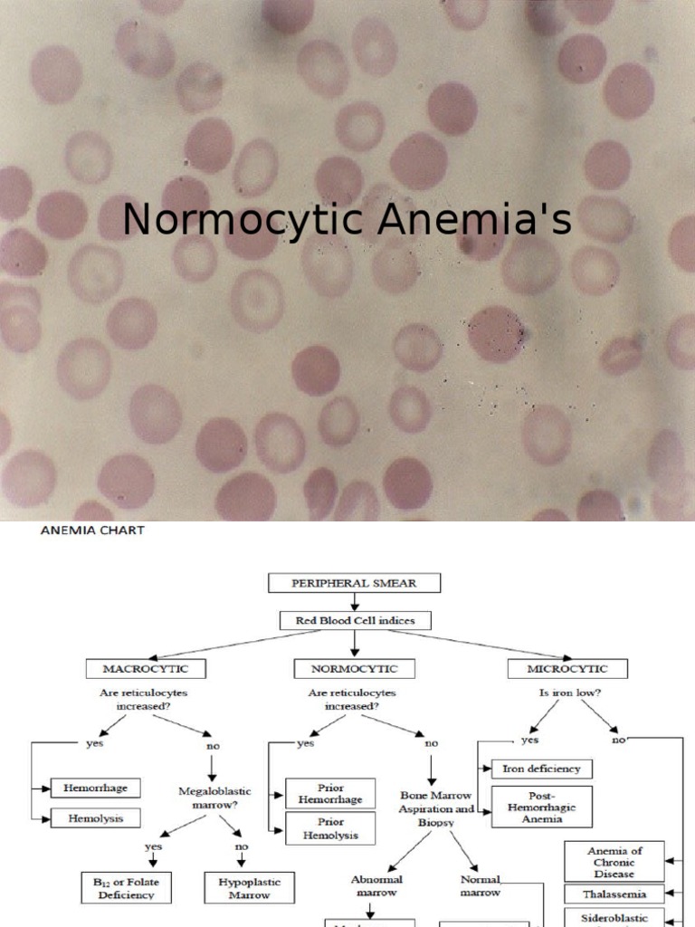 Normocytic Anemia's PDF Anemia Medical Specialties