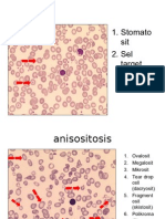 Tugas PK Praktikum Sel Darah Abnormal