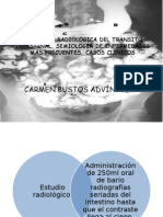 Anatomia Radiologica Del Transito Intestinal