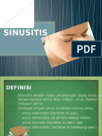 Sinusitis