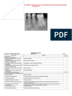 Treatment of Periodontitis Permanent Teeth in Children. Choice of Treatment. Features Endodontic Procedures in Permanent Teeth With Immature Root