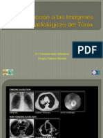 Introducción a las Imágenes Radiológicas del Tórax