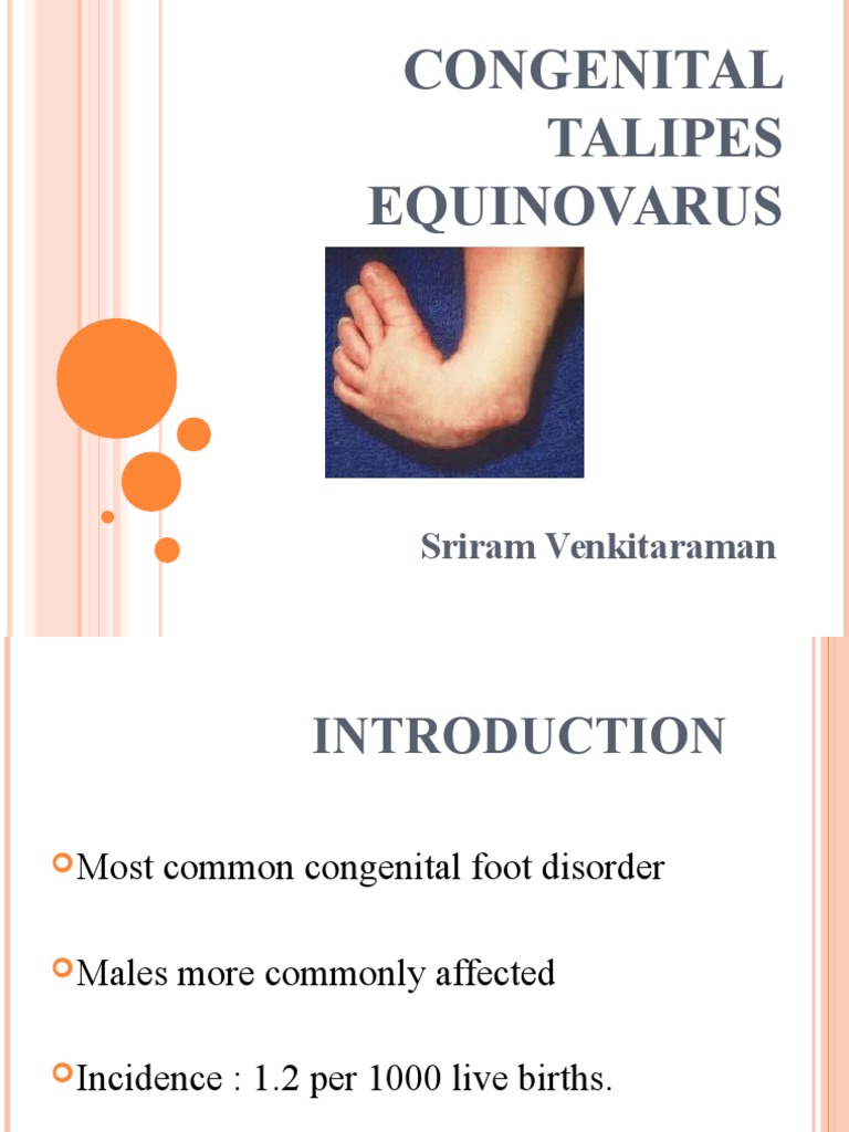 Congenital Talipes Equinovarus Final PDF Foot Skeletal System