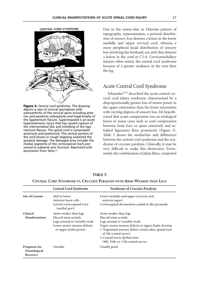 Clinical Manifestation of Acute Spinal Cord Injury | PDF | Spinal Cord ...