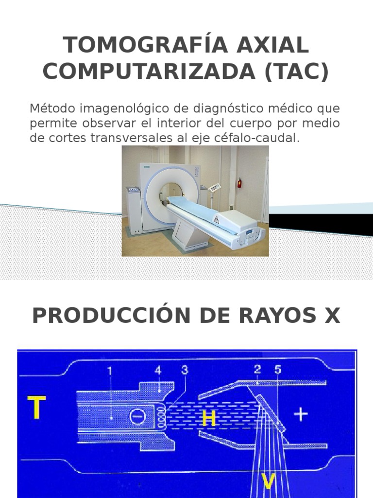 Tomografía Axial Computarizada (Tac) | PDF