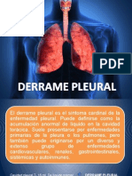 Derrame Pleural