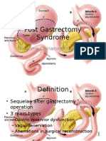 Post Gastrectomy Syndrome