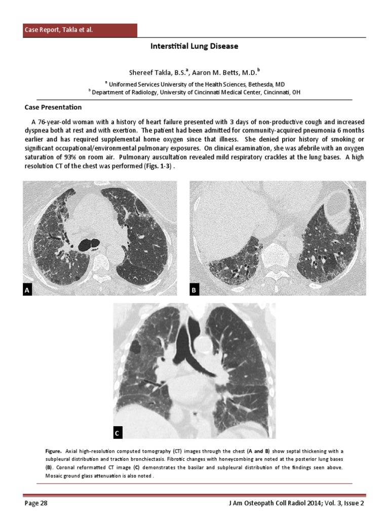 Interstitial Lung Disease | PDF | Respiratory System | Diseases And ...