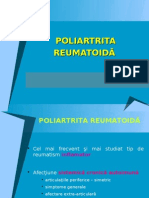 Poliartrita ReumatoidĂ