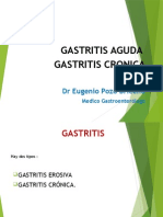 Gastritis Clases 