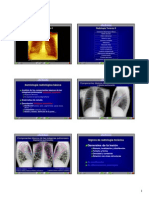 WWW - Ameram.es 1.1 PDF 08-Torax2