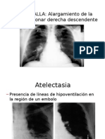 Radiologia Trombo Embolo Pulmonar