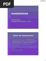 Fisioterapia Dermatofuncional e Disfuncoes Endocrinometabolicas Aula Hanseniase