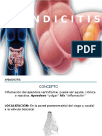 Apendicitis