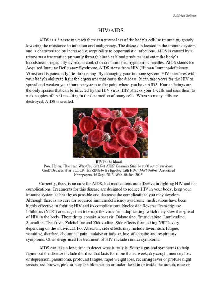 Hiv & Aids Essay | PDF | Candidiasis | Hiv/Aids