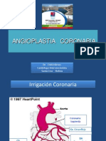 Angioplastia coronaria: conceptos básicos y procedimiento