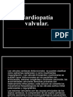 Cardiopatía Valvular Estenosis Aortica