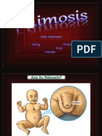 Phimosis