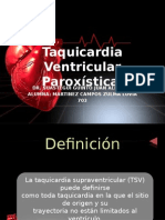 Taquicardia Ventricular Paroxística
