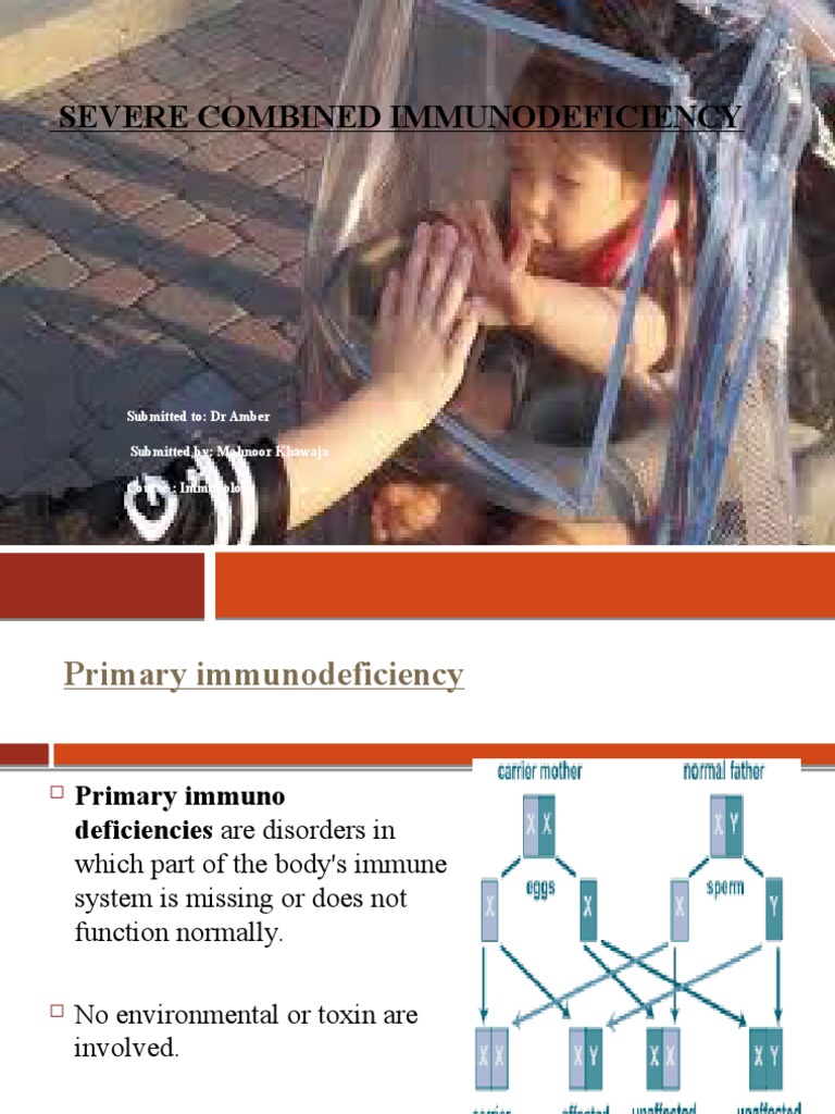Understanding Severe Combined Immunodeficiency | PDF