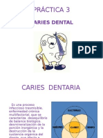 p3 Caries Dentaria