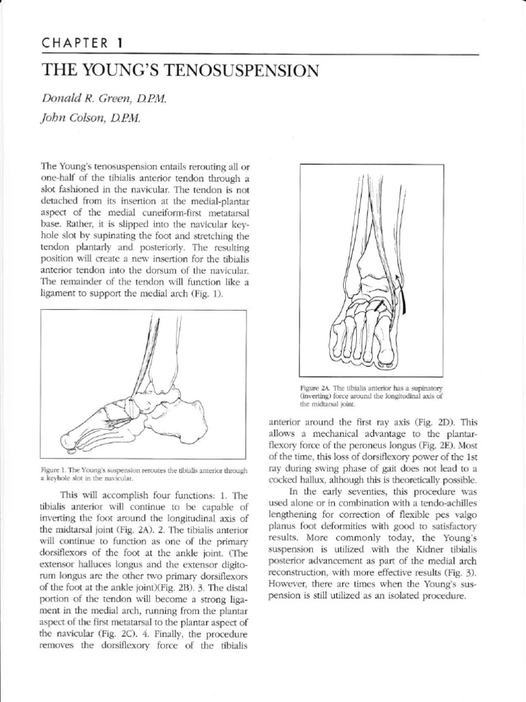 Young's Tenosuspension PDF Foot Anatomical Terms Of Location