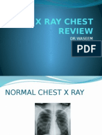 X Ray Chest Review