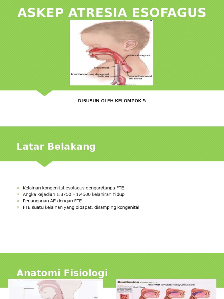 Penanganan Atresia Esofagus pada Bayi | PDF | Kesehatan Holistik ...