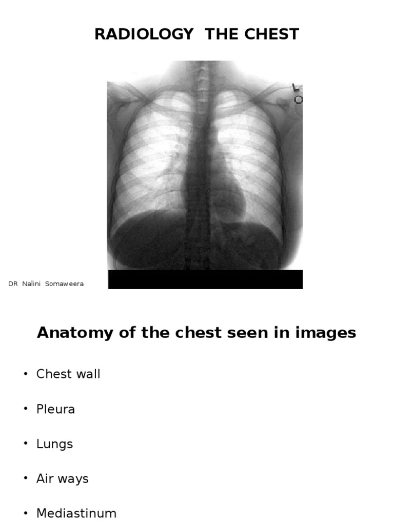 Chest Radiology Aorta Thorax