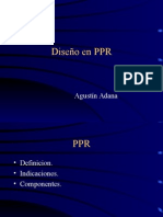 diseño en prótesis parcial removible