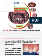 2.- Enfermedad Periodontal a