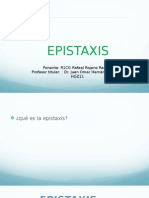 Epistaxis