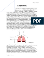 Lung Cancer