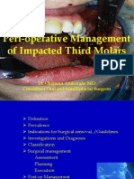 Peri-operative Management of Impacted Third Molars [Autosaved]
