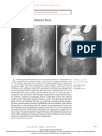 Gallstone Ileus