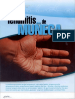 Tendinitis de Muñecaa