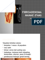 Fibroadenoma Mamae (Fam) - Hana